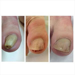 pedicure podologiczny Warszawa
